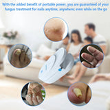 Nail Fungus Remover Device